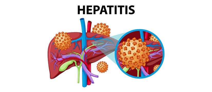 Hepatitis Image