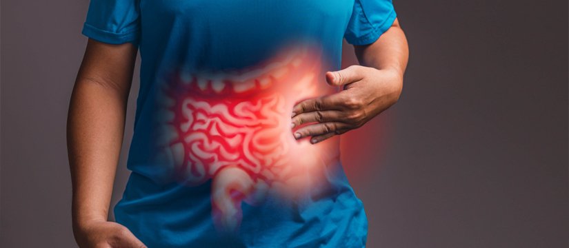 Irritable Bowel Syndrome Image